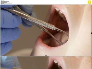 检查口腔视频,揭秘口腔健康秘密